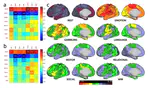 Inter and Intra individual Variations of Cortical Fine-grained Functional Boundaries Depend on the Brain States