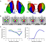 The human mediodorsal thalamus: Organization, connectivity, and function